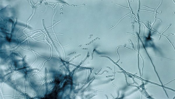 Antibiyotik 'Megacluster' Keşfi, Süper Mikroplarla Mücadelede Yeni Strateji Sunuyor