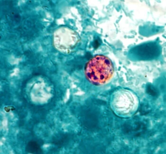 FDA'dan Yeni Cyclospora Salgını Açıklaması: 72 Vaka Tespit Edildi