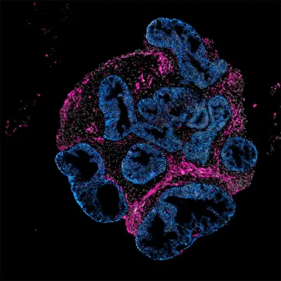 Denver merkezli Intero Biosystems ilaç firmalarından hayvan yerine mini insan bağırsağı üzerinde test yapmasını istiyor